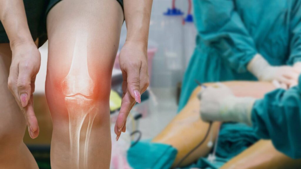 Clínica Cord - Cirurgia de Joelho