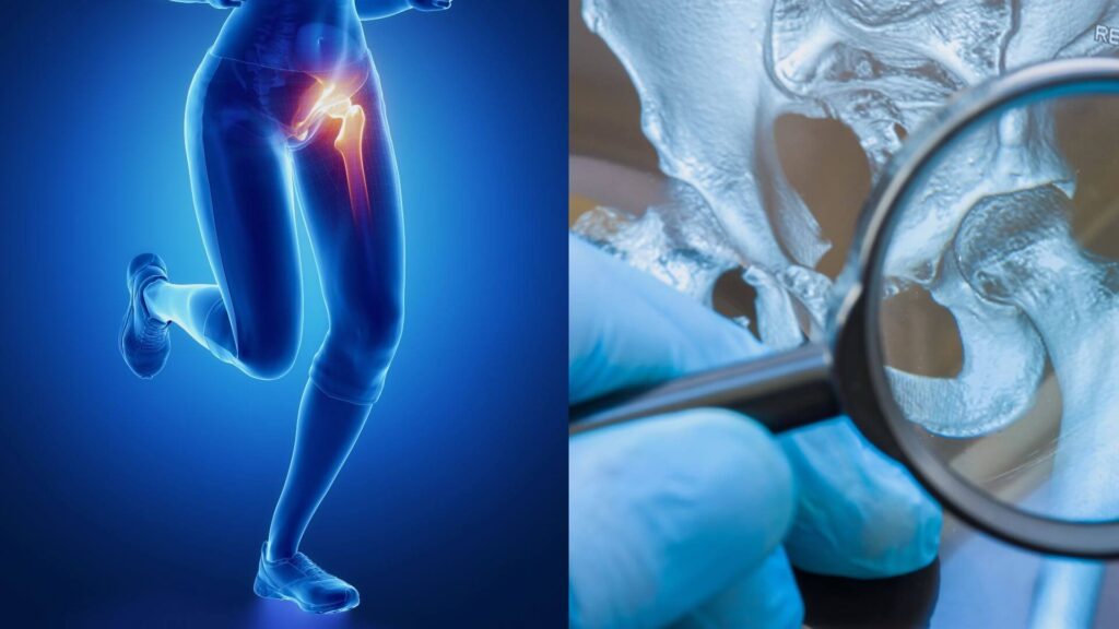 Clínica Cord - osteoartrite de quadril